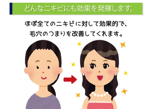 どんなニキビにも効果を発揮します。